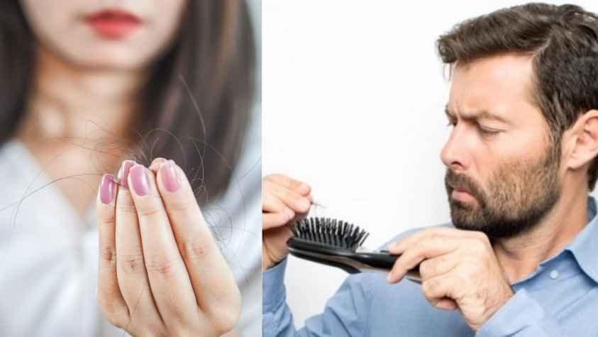 முடி உதிர்வை குறைக்க சாப்பிட வேண்டிய உணவுகள் | Foods to Avoid Hair Fall image