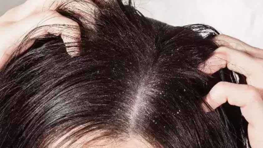 முடி கொட்டிட்டே இருக்கா.? கறிவேப்பிலை இப்படி பயன்படுத்துங்க..! அப்றம் எப்படி முடி உதிர்வு ஸ்டாப் ஆகுதுனு பாருங்க.. | How to Use Karuveppilai for Hair in Tamil