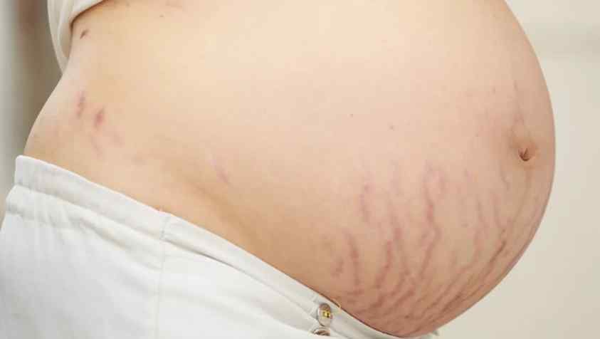 கர்ப்பம் மாதம் 5: கர்ப்பத்தின் 5வது மாதத்தில் ஏற்படும் உடல் & மன மாற்றங்கள்.. | Body Changes in 5th month of Pregnancy